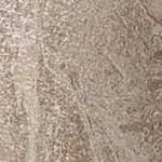 Вставка Privilege Grigio Bottone Lappato